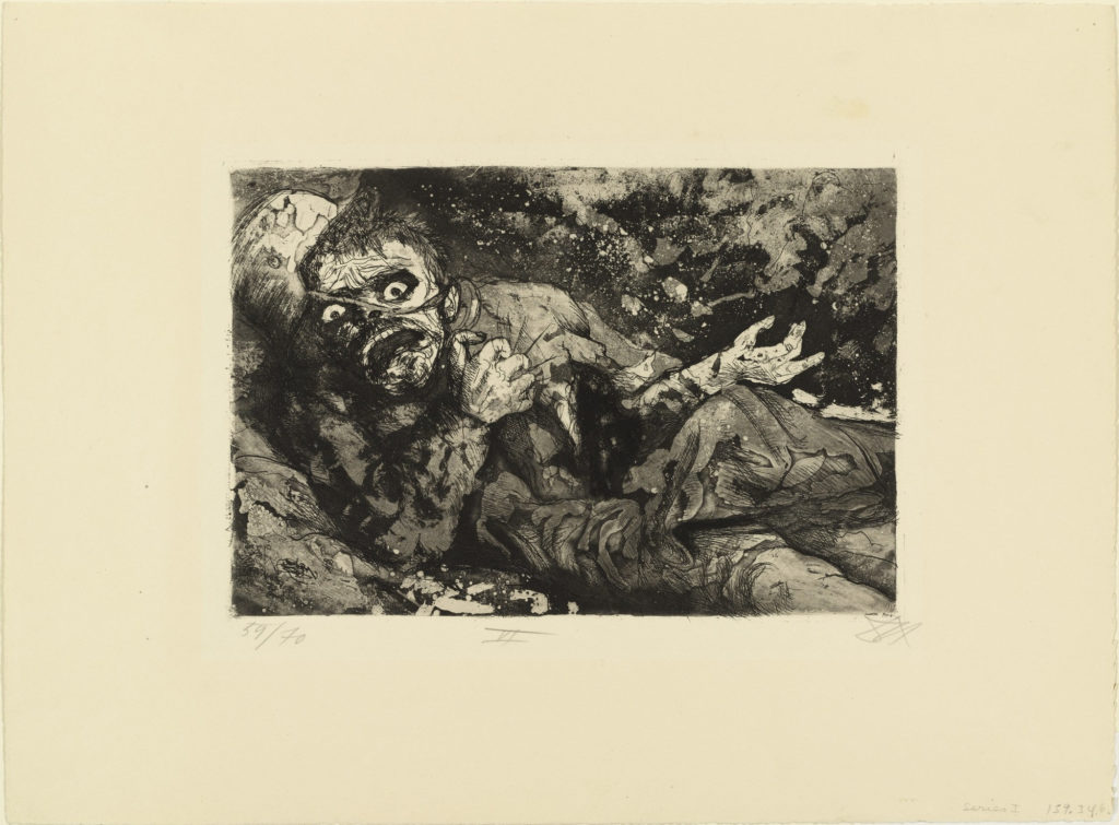 Wounded man (Autumn 1916, Bapaume), from The War, 1924, etching and aquatint from a portfolio of fifty etching, aquatint and drypoints, © 2016 Artists Rights Society (ARS), New York / VG Bild-Kunst, Bonn.  etchings of Otto Dix