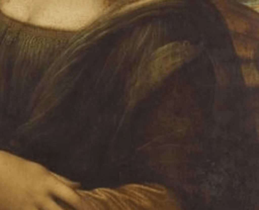 Mona Lisa illnesses:, Leonardo di ser Piero da Vinci, Portrait of Lisa Gherardini, ca. 1503–19, Louvre Museum, Paris. Enlarged detail: blanket.