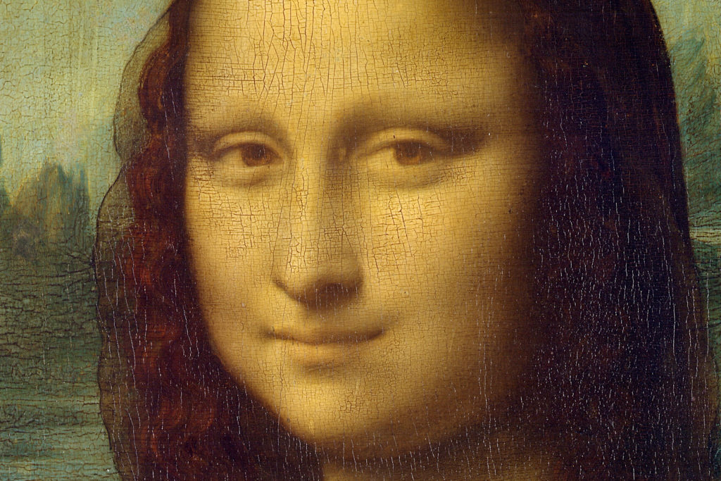 Mona Lisa illnesses: Leonardo di ser Piero da Vinci, Portrait of Lisa Gherardini, ca. 1503–19, Louvre Museum, Paris. Face pathology