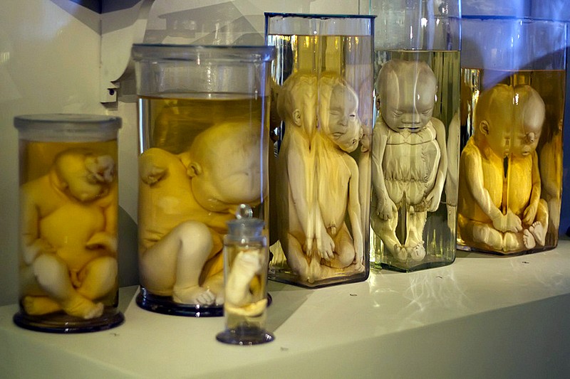 Examples of embryo located in the Kunstkamera of Peter the Great, Saint Petersburg, Russia. Source: www.saint-petersburg.com. Cabinets of Curiosities; wunderkammer