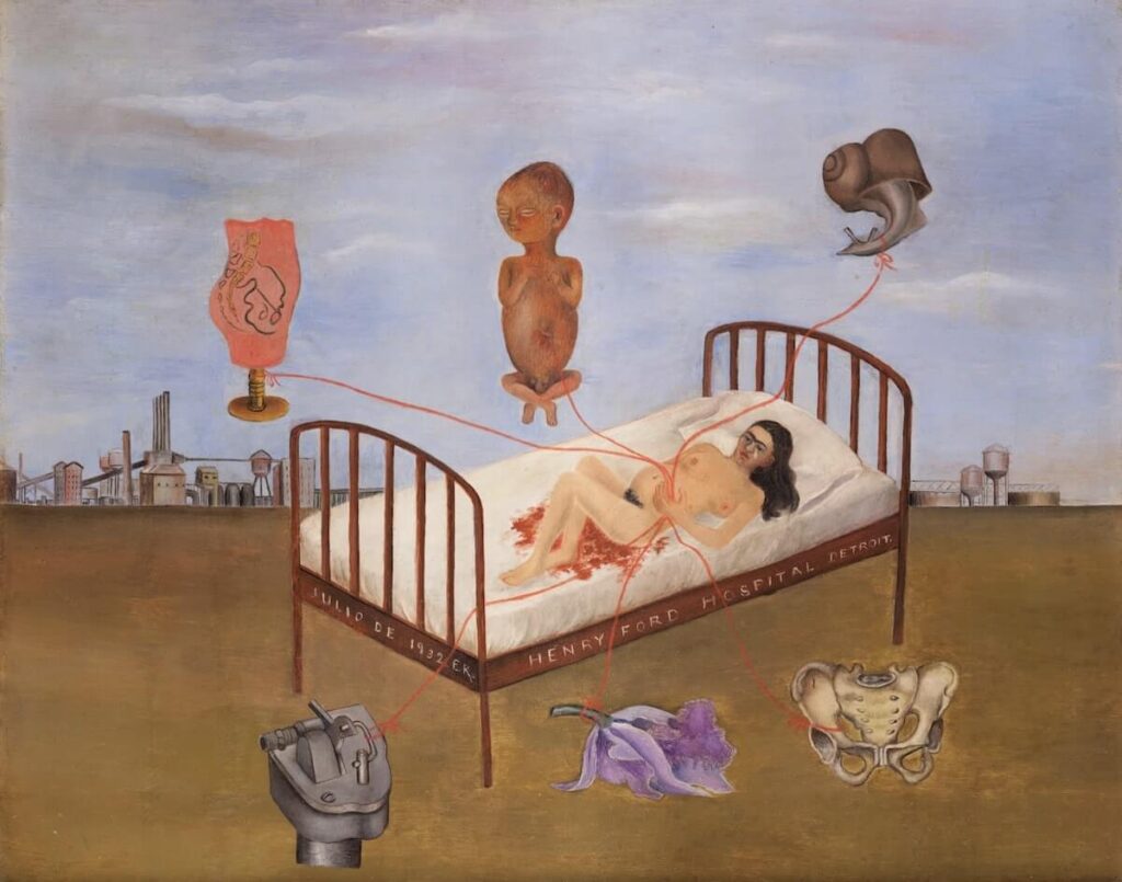 sickness in art: Frida Kahlo, Henry Ford Hospital, 1932, Museo Dolores Olmedo, Mexico, Mexico. Artist’s website.
