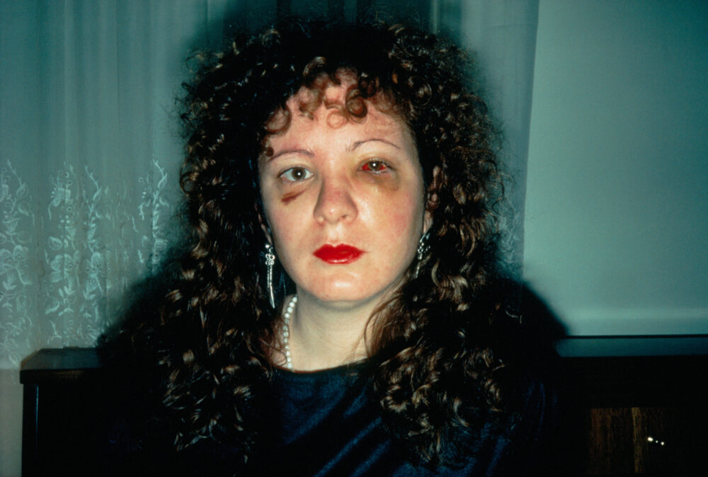 Nan Goldin: Nan Goldin, Nan one month after being battered, 1984, Tate, London, UK.
