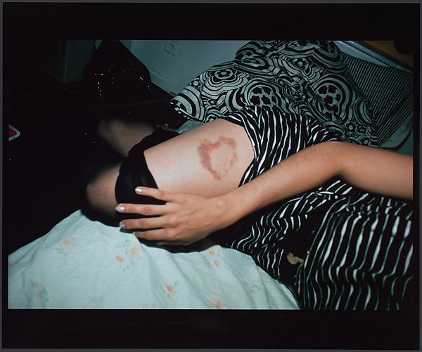 Nan Goldin: Nan Goldin, Heart Shaped Bruise, 1980, Museum of Modern Art, New York, NY, USA.
