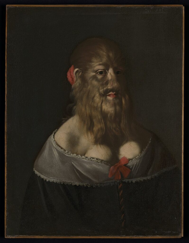 Bearded Woman: Giovanni Francesco Guerrieri, Barbara van Beck, 17th century, Wellcome Collection, London, UK.

