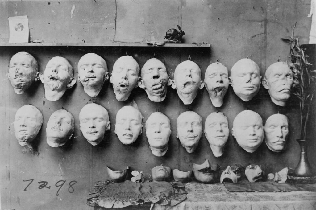 Anna Coleman Ladd: Masks showing different stages of work: casts taken from the soldiers’ mutilated faces; the lower row shows the faces modeled on the foundation of the life mask. On the table rest some of the final masks made to fit over the disfigured part of the face. France, 1918, Library of Congress, Washington, DC, USA. Library’s website.
