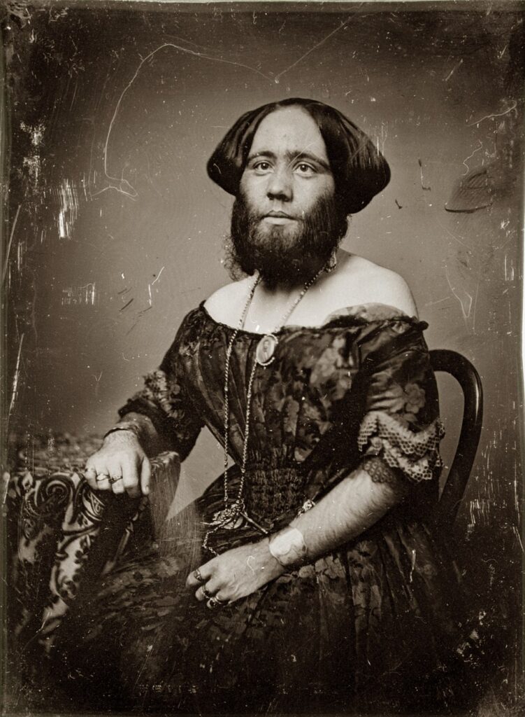 Bearded Woman: Portrait of Josephine Clofullia, 1853, Missouri History Museum, St. Louis, MO, USA. Photograph by Thomas Martin Easterly.
