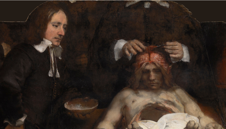 anatomy lesson of dr deijman: Rembrandt, The Anatomy Lesson of Dr. Deijman, 1656, Rembrandt House Museum, Amsterdam, Netherlands, on loan from the Amsterdam Museum until August 30, 2026. Detail.
