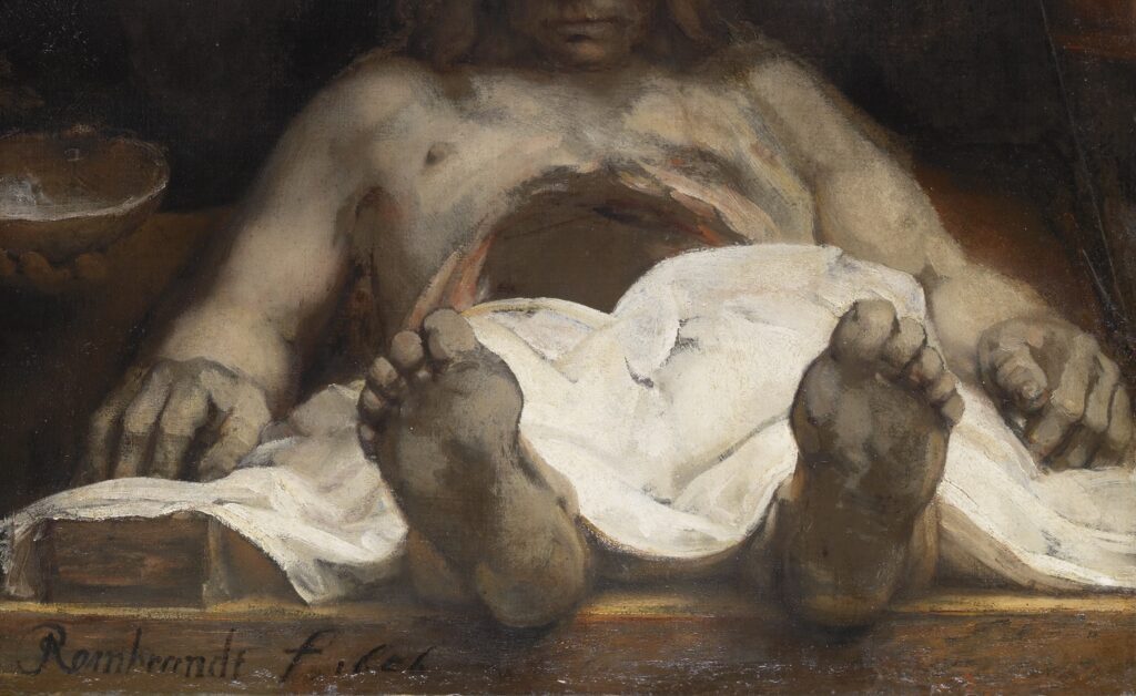 anatomy lesson of dr deijman: Rembrandt, The Anatomy Lesson of Dr. Deijman, 1656, Rembrandt House Museum, Amsterdam, Netherlands, on loan from the Amsterdam Museum until August 30, 2026. Detail.

