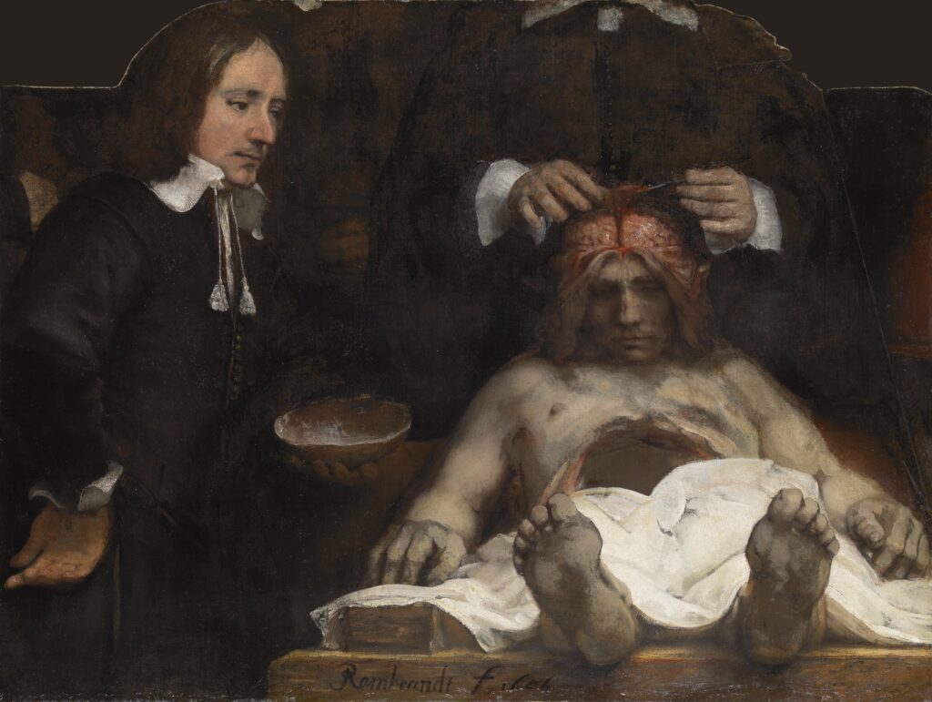 anatomy lesson of dr deijman: Rembrandt, The Anatomy Lesson of Dr. Deijman, 1656, Rembrandt House Museum, Amsterdam, Netherlands, on loan from the Amsterdam Museum until August 30, 2026.
