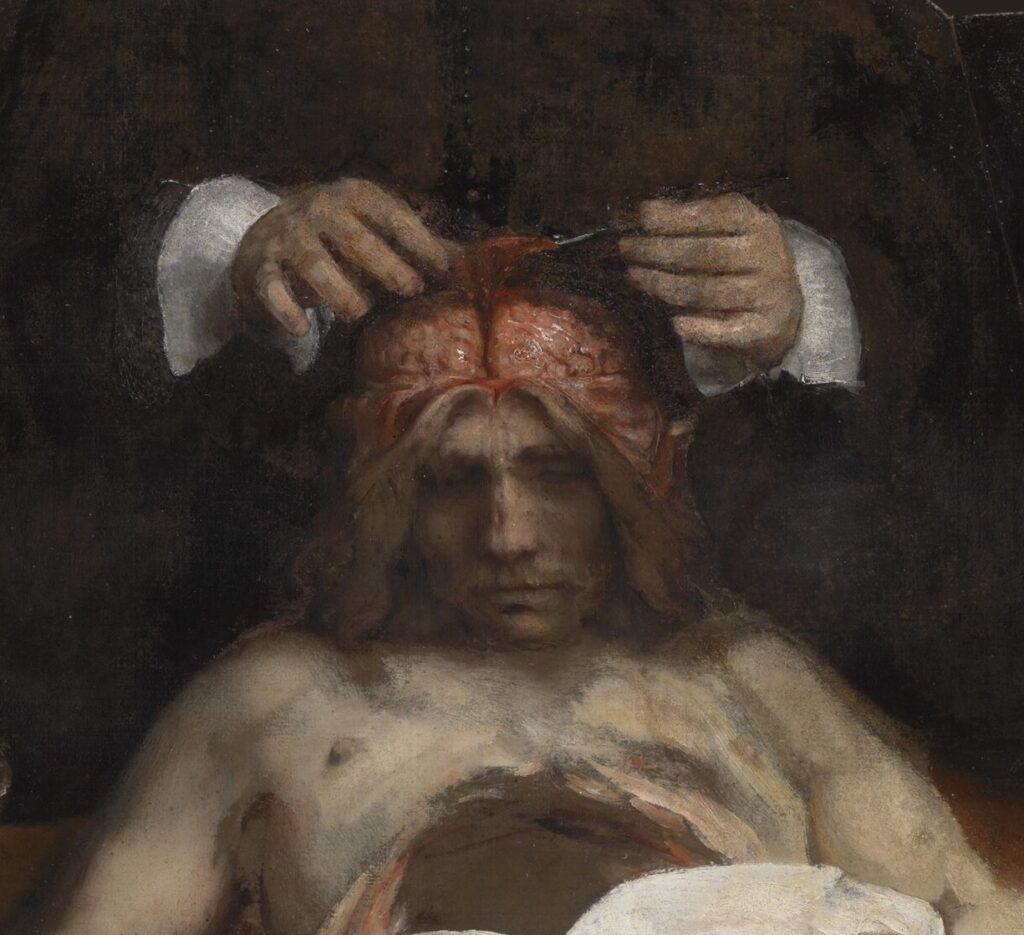 anatomy lesson of dr deijman: Rembrandt, The Anatomy Lesson of Dr. Deijman, 1656, Rembrandt House Museum, Amsterdam, Netherlands, on loan from the Amsterdam Museum until August 30, 2026. Detail.
