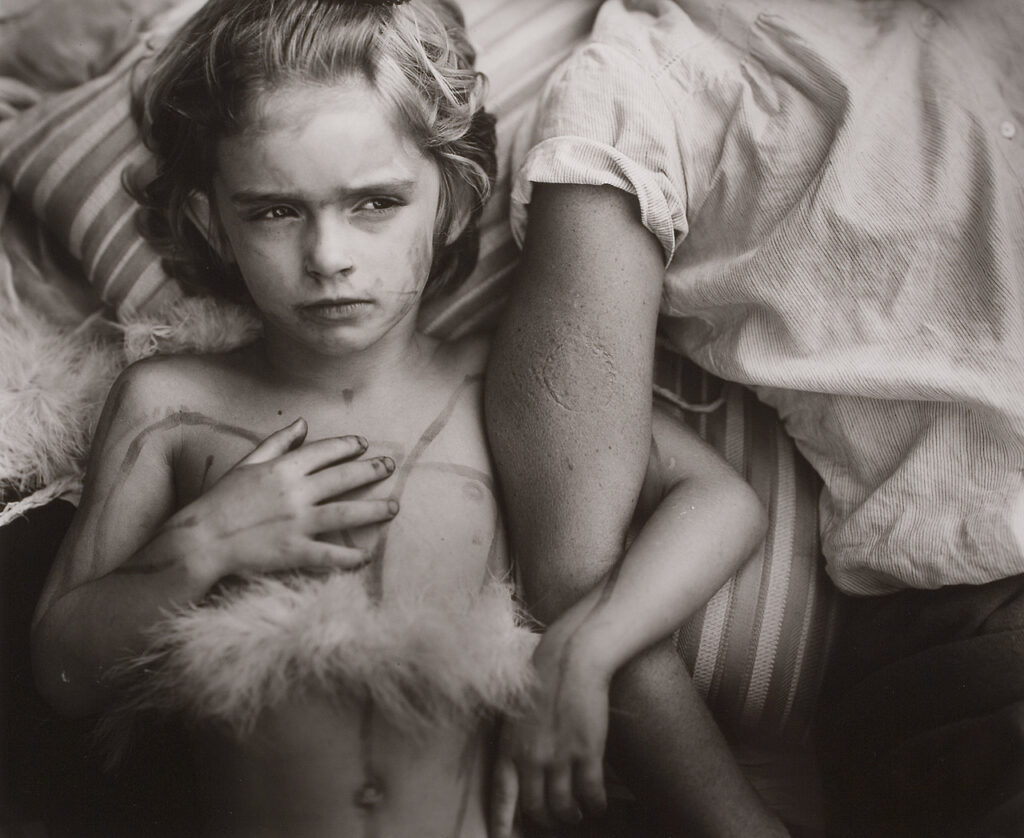 Nude Children in Art: Sally Mann, Jessie Bites, 1985, Solomon R. Guggenheim Museum, New York Gift, The Bohen Foundation, 2001. © Sally Mann.
